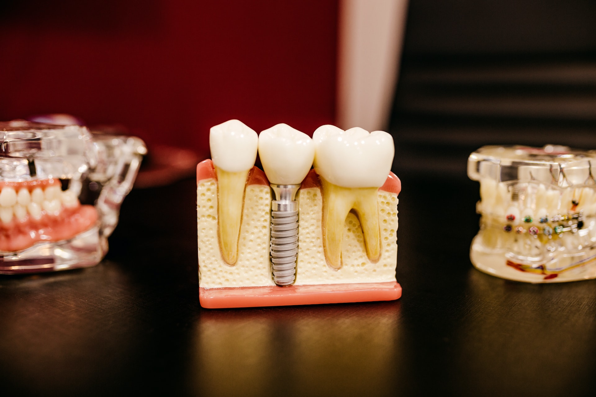 Восстановление формы и функциональности зуба