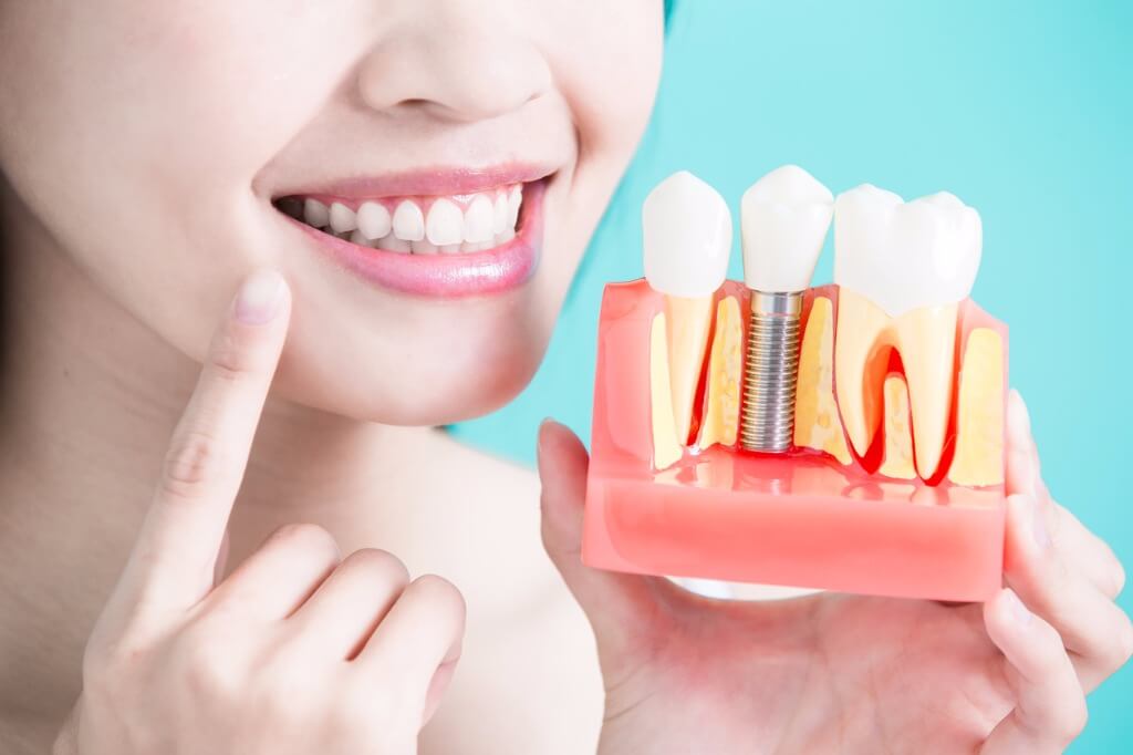 Как лучше протезировать зубы