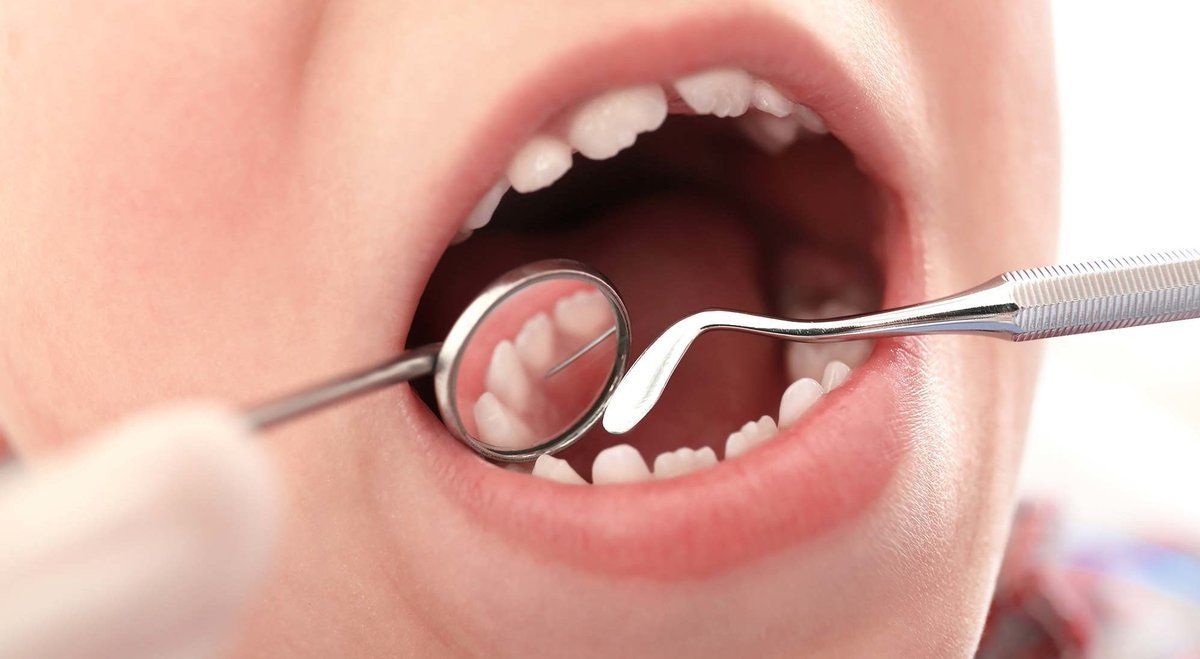 Лечение кариеса молочных зубов у детей: нужно ли и как проводится