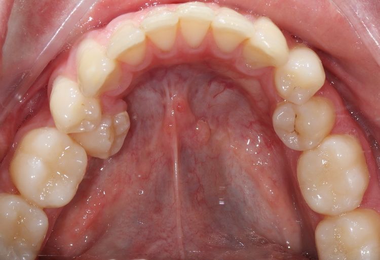 Примеры работ врача стоматолога, ортодонта
